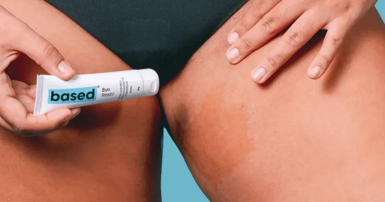 Foliculite na virilha